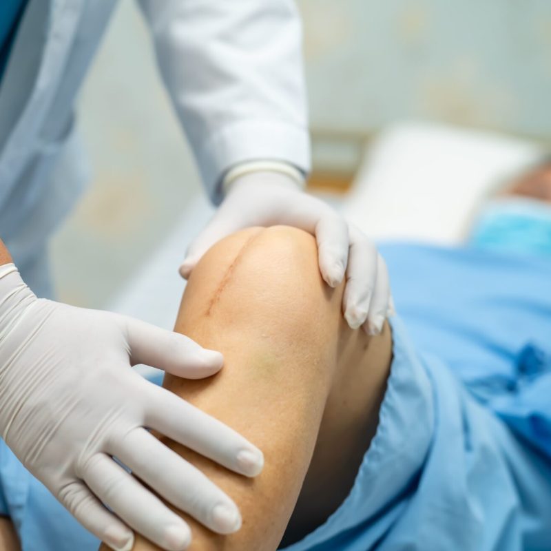 Old age knee replacement